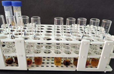 Proteina C reactivă prezice infarctul mai bine decât colesterolul
