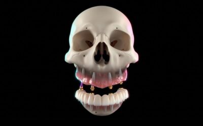 Soluția dinți ficși în 24 de ore elimină definitiv proteza mobilă