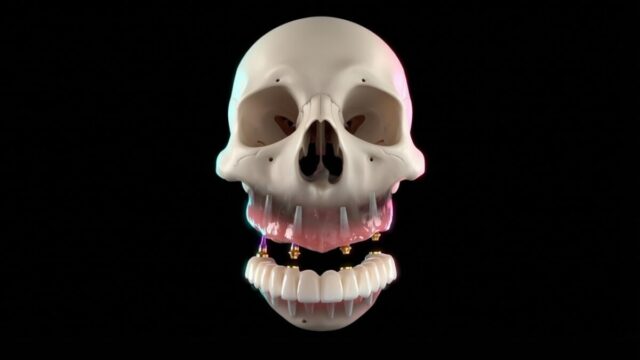 Soluția dinți ficși în 24 de ore elimină definitiv proteza mobilă