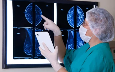 Densitatea mamară un risc de cancer ce afectează 40% din femei