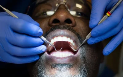 Adevărul despre plombele dentare. Când poți refuza freza stomatologului