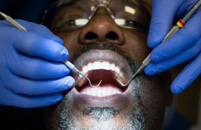 Adevărul despre plombele dentare. Când poți refuza freza stomatologului
