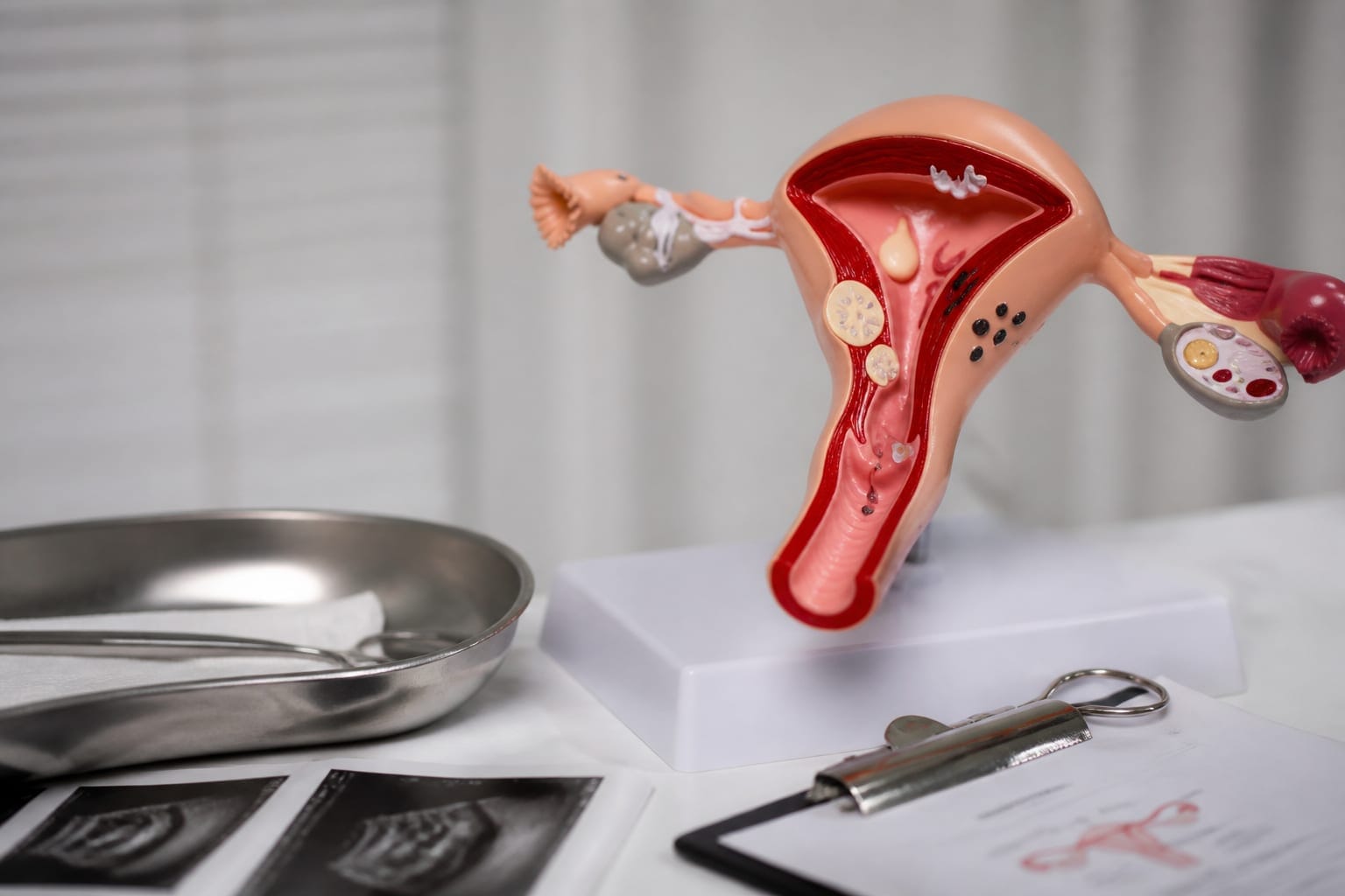 75% dintre femei au cel puțin o infecție vaginală cu ciuperci de-a lungul vieții